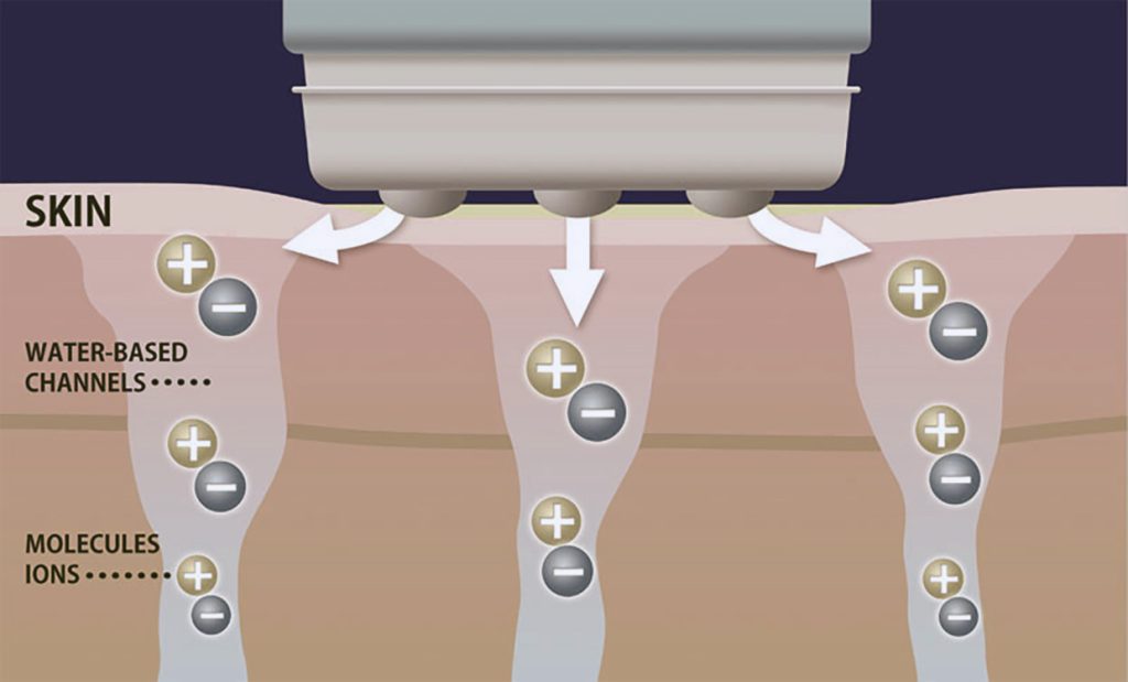 Transdermal Collagenzing